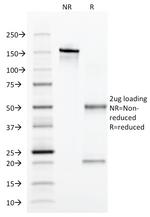 Alpha-1-Antitrypsin (SERPINA1) Antibody in SDS-PAGE (SDS-PAGE)