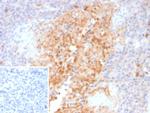 Alpha-1-Antitrypsin (SERPINA1) (Hepatocellular and Histiocytic Marker) Antibody in Immunohistochemistry (Paraffin) (IHC (P))