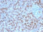 Alpha-1-Antitrypsin (SERPINA1) (Hepatocellular and Histiocytic Marker) Antibody in Immunohistochemistry (Paraffin) (IHC (P))