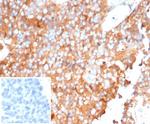 Alpha-1-Antitrypsin (SERPINA1) (Hepatocellular and Histiocytic Marker) Antibody in Immunohistochemistry (Paraffin) (IHC (P))