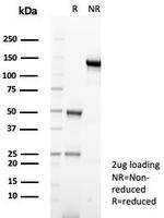 Alpha-1-Antitrypsin (SERPINA1) (Hepatocellular and Histiocytic Marker) Antibody in SDS-PAGE (SDS-PAGE)