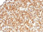 Alpha-1-Antitrypsin (SERPINA1) (Hepatocellular and Histiocytic Marker) Antibody in Immunohistochemistry (Paraffin) (IHC (P))