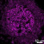 CD20 Antibody in Immunohistochemistry (IHC)