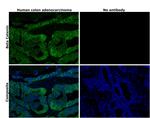 beta Catenin Antibody in Immunohistochemistry (Paraffin) (IHC (P))