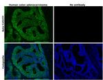 beta Catenin Antibody in Immunohistochemistry (Paraffin) (IHC (P))