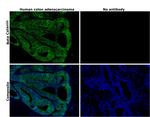 beta Catenin Antibody in Immunohistochemistry (Paraffin) (IHC (P))