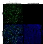 Ki-67 Antibody in Immunohistochemistry (Paraffin) (IHC (P))