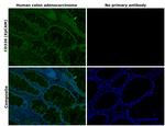 CD326 (EpCAM) Antibody in Immunohistochemistry (Paraffin) (IHC (P))