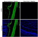 Alpha-Smooth Muscle Actin Antibody