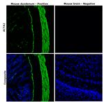 Alpha-Smooth Muscle Actin Antibody