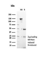 GCDFP-15 (Gross Cystic Disease Fluid Protein 15) (Breast Marker) Antibody in SDS-PAGE (SDS-PAGE)