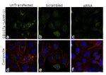 CD107a (LAMP-1) Antibody in Immunocytochemistry (ICC/IF)