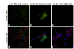 beta-3 Tubulin Antibody