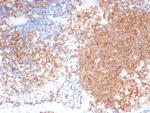 PLK1 Antibody in Immunohistochemistry (Paraffin) (IHC (P))