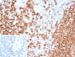 PLK1 Antibody in Immunohistochemistry (Paraffin) (IHC (P))