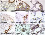 Podoplanin Antibody in Immunohistochemistry (IHC)