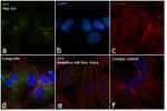 alpha-Fetoprotein Antibody