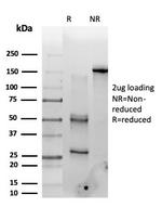 PMS1 Antibody in SDS-PAGE (SDS-PAGE)