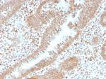 PMS2 (Postmeiotic Segregation Increased 2) Antibody in Immunohistochemistry (Paraffin) (IHC (P))