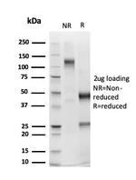 PMS2 (Postmeiotic Segregation Increased 2) Antibody in SDS-PAGE (SDS-PAGE)