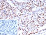 PMS2 (Postmeiotic Segregation Increased 2) Antibody in Immunohistochemistry (Paraffin) (IHC (P))