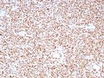 PMS2 (Postmeiotic Segregation Increased 2) Antibody in Immunohistochemistry (Paraffin) (IHC (P))