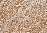 PMS2 (Postmeiotic Segregation Increased 2) Antibody in Immunohistochemistry (Paraffin) (IHC (P))