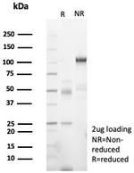 PMS2 (Postmeiotic Segregation Increased 2) Antibody in SDS-PAGE (SDS-PAGE)