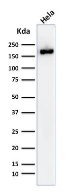 Podocalyxin (PODXL) (Hematopoietic Stem Cell Marker) Antibody in Western Blot (WB)