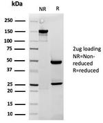 Cytochrome C Antibody in SDS-PAGE (SDS-PAGE)