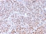 Phospho-RNA Polymerase II CTD Repeat YSPTSPS (Ser5) Antibody in Immunohistochemistry (Paraffin) (IHC (P))