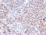 Phospho-RNA pol II CTD (Ser5) Antibody in Immunohistochemistry (Paraffin) (IHC (P))