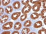 Cytokeratin 20 (KRT20) (Colorectal Epithelial Marker) Antibody in Immunohistochemistry (Paraffin) (IHC (P))