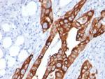 Cytokeratin 20 (KRT20) (Colorectal Epithelial Marker) Antibody in Immunohistochemistry (Paraffin) (IHC (P))