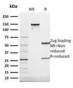 Cytokeratin 20 (KRT20) (Colorectal Epithelial Marker) Antibody in SDS-PAGE (SDS-PAGE)