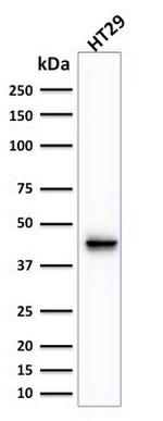 Cytokeratin 20 (KRT20) (Colorectal Epithelial Marker) Antibody in Western Blot (WB)