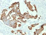 Cytokeratin 20 (KRT20) (Colorectal Epithelial Marker) Antibody in Immunohistochemistry (Paraffin) (IHC (P))