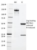 Cytokeratin 20 (KRT20) (Colorectal Epithelial Marker) Antibody in SDS-PAGE (SDS-PAGE)