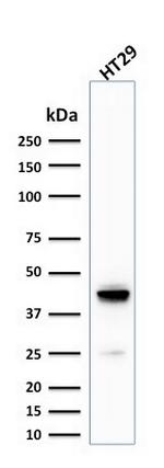 Cytokeratin 20 (KRT20) (Colorectal Epithelial Marker) Antibody in Western Blot (WB)