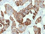 Cytokeratin 20 (KRT20) Antibody in Immunohistochemistry (Paraffin) (IHC (P))