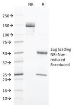 Cytokeratin 20 (KRT20) Antibody in SDS-PAGE (SDS-PAGE)