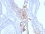 Cytokeratin 20 (KRT20) (Colorectal Epithelial Marker) Antibody in Immunohistochemistry (Paraffin) (IHC (P))