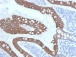 Cytokeratin 20 (KRT20) (Colorectal Epithelial Marker) Antibody in Immunohistochemistry (Paraffin) (IHC (P))