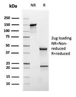 Cytokeratin 20 (KRT20) (Colorectal Epithelial Marker) Antibody in SDS-PAGE (SDS-PAGE)