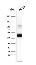 Cytokeratin 20 (KRT20) (Colorectal Epithelial Marker) Antibody in Western Blot (WB)