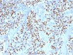 OCT-2 (POU2F2) Antibody in Immunohistochemistry (Paraffin) (IHC (P))