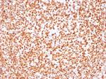 OCT-2 (POU2F2) Antibody in Immunohistochemistry (Paraffin) (IHC (P))