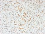 ATRX/RAD54 (Alpha Thalassemia Mental Retardation) Antibody in Immunohistochemistry (Paraffin) (IHC (P))