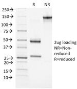 ATRX/RAD54 (Alpha Thalassemia Mental Retardation) Antibody in SDS-PAGE (SDS-PAGE)