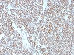 ATRX/RAD54 (Alpha Thalassemia Mental Retardation) Antibody in Immunohistochemistry (Paraffin) (IHC (P))